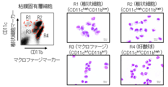 形質 リンパ 腸炎 性 球 細胞