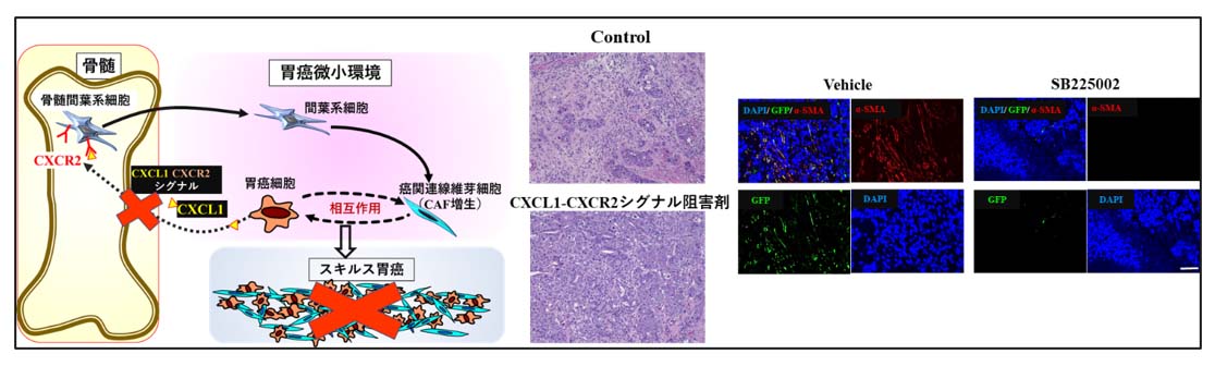 >CXCL1-CXCR2シグナル阻害剤による難治癌治療薬開発研究