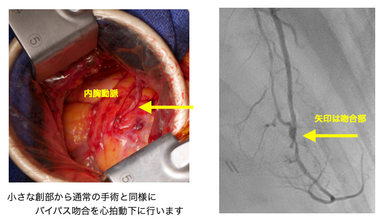 大阪公立大学大学院 外科学講座 公式サイト 心臓血管外科